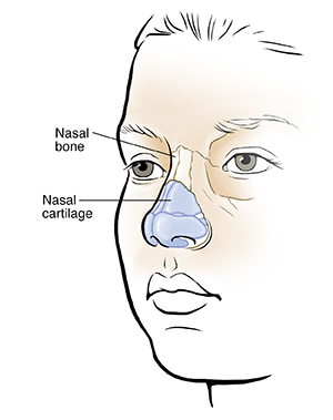 Three-quarter view of child's face showing nasal bones and cartilage.